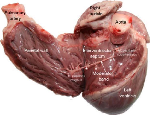 VENTRICULUS DEXTER TRABECULA SEPTOMARGINALIS (MODERÁTOR KÖTEG): összeköti a kamra falat a septum