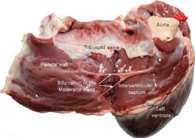 VENTRICULUS SINISTER TRABECULA SEPTOMARGINALIS (MODERÁTOR KÖTEG) sertés https://www.semanticscholar.