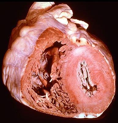 munkaizom humán szív ló Myocardium Ventriculus dexter Myocardium