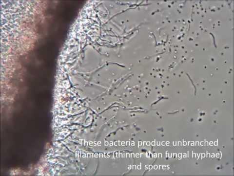 Streptomyces platensis fonalas sejtek és a