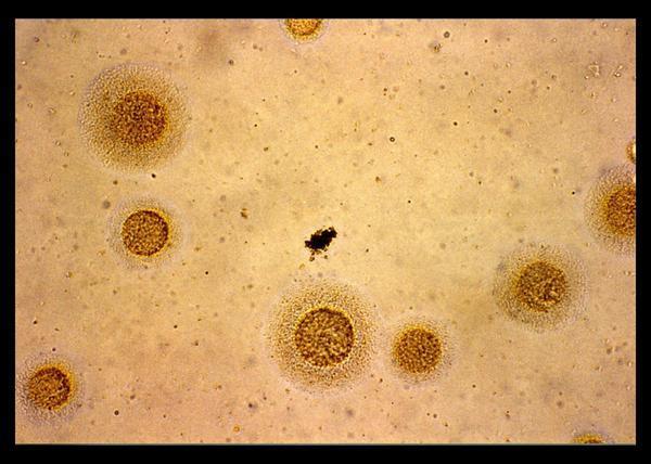 Halobacterium, Owens Lake, California Mycoplasma