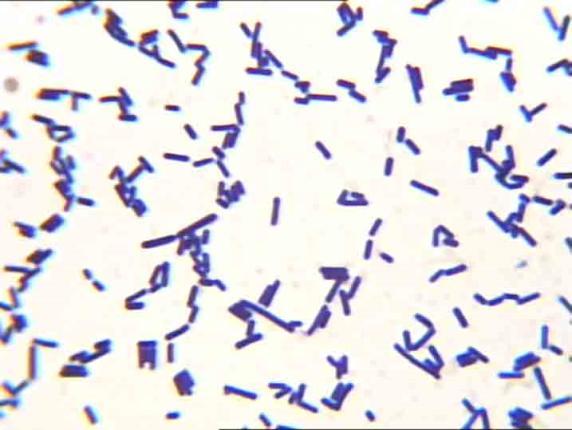 edu/courses/bio141/l abmanua/lab6/images/ecoli01_scale.