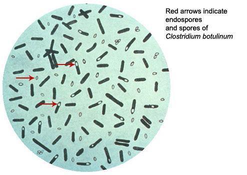 Endospóraképzés Bacillus, Clostridium, Sporosarcina sp.