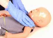 Csemő és gyermek újraélesztés Gyermek és csecsemő korban a légzésleállás leggyakoribb oka az oxigénhiány, vagy légúti probláma.