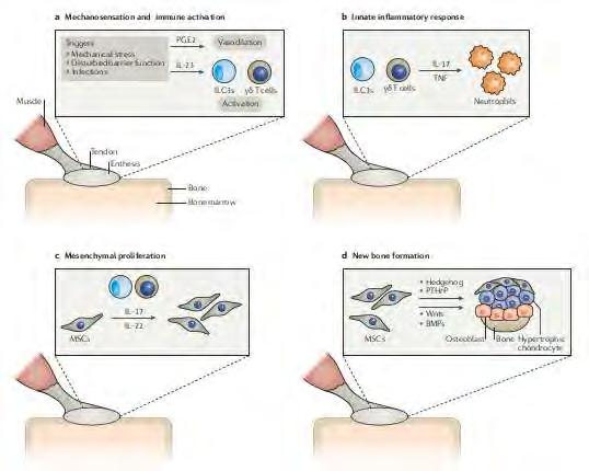 Az enthesitis immunpathogenezise a) Mechanikus stress és immunaktiváció b) Innate immunitás gyulladásos válasza c)
