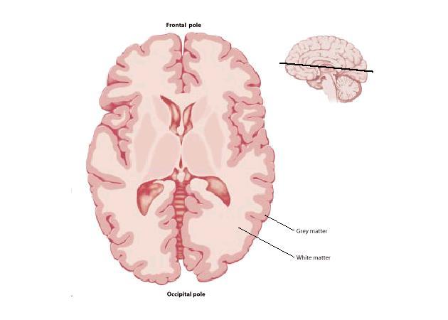 Agykéreg - cortex szürke