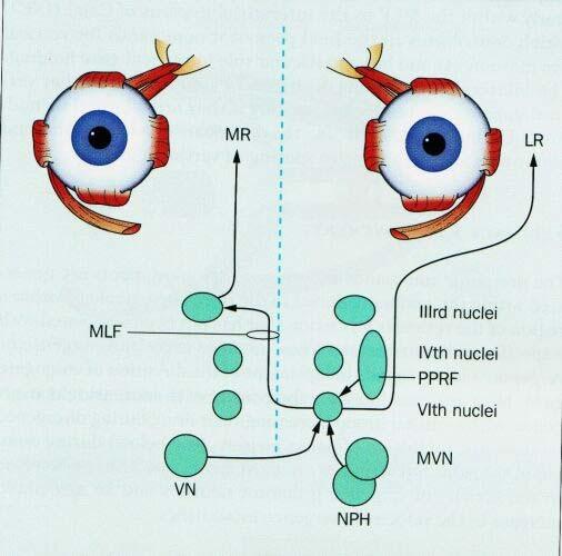 SUPRANUCLEARIS szemmzgató