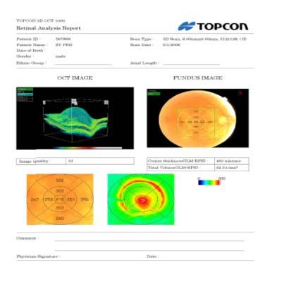 Optic Disk 250 µm