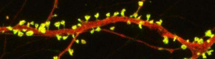 E: Dendro dendritic Retina, olfactory bulb 49 A