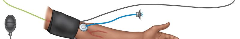 Slowly reduce the pressure in the cuff while listening through the stethoscope for Korotkoff sounds.