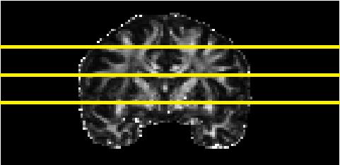 Figure VI.1:The three planes of investigation In the transversal plane z=50 mm, the fractional anisotropy images were the following: Figure VI.