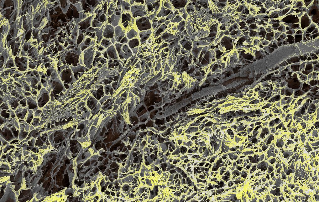 Tissue Extracellular Matrix (ECM) ECM Key Facts Present in all tissues and functions as the biological scaffold for cells Contains structural, adhesion and signaling molecules Tissue function and