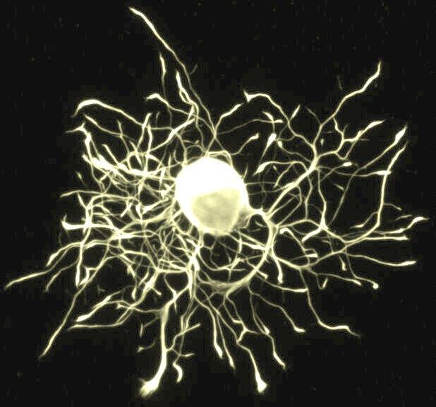 272/370 Történeti áttekintő II Neuron 11 Idegsejt fényképe: