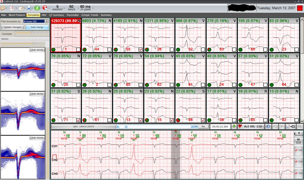 3.2 ECG Electrocardiogram Figure 29: Full screen of the
