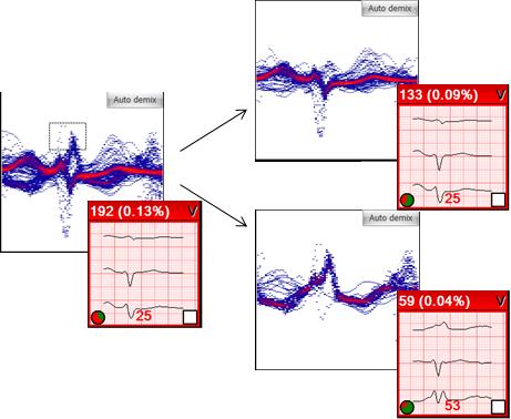 3.2 ECG Electrocardiogram its color becomes redder and redder. The aim is that the more heartbeats go to an area, the more powerful the representation should be.