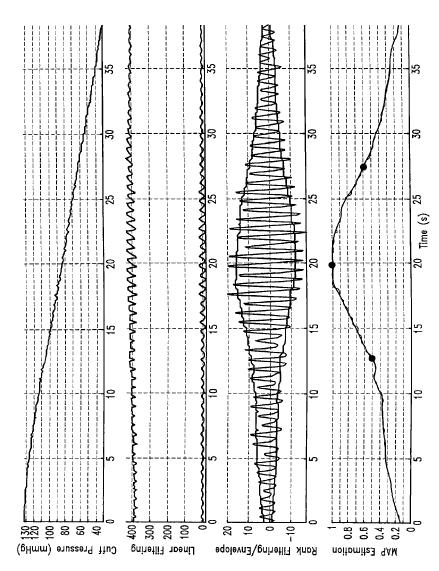 3.3 Blood pressure measurement Figure 33: The curves belong to the main steps of the oscillometric technique of Aboy (2011) (Original picture) The