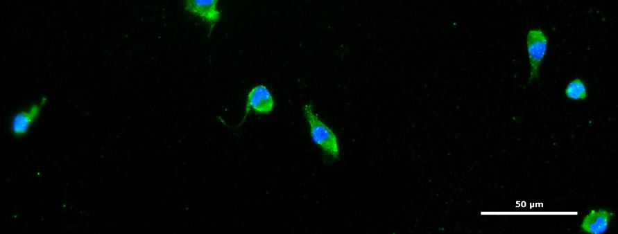 peritoneal rat macrophages by immunofluorescence.