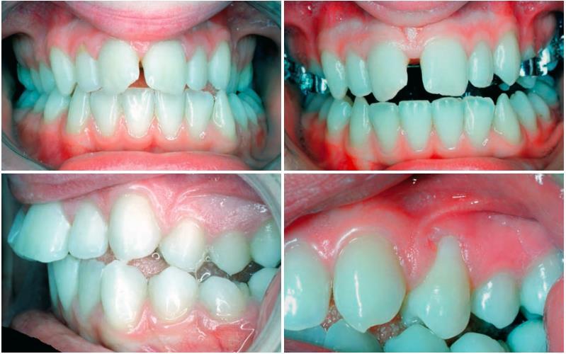 Graber: Orthodontics, 5th Edition