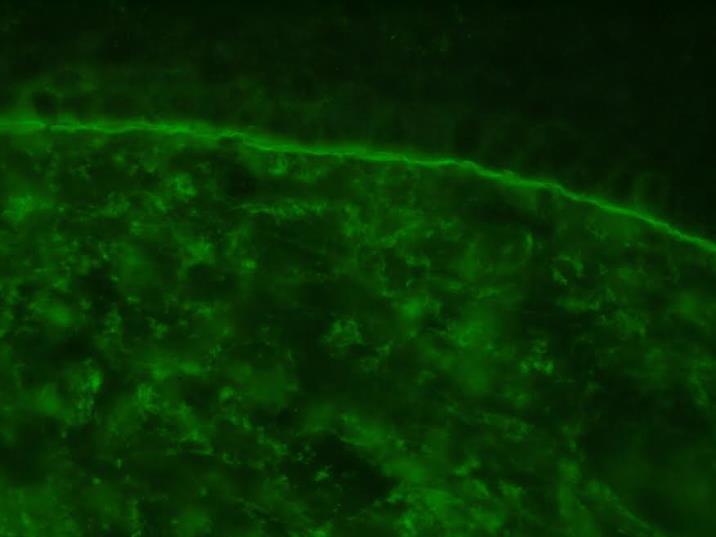 Intradermalis intercelluláris festődés