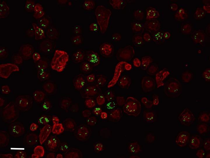 1.3.1.1. A plazmatociták A plazmatociták körülbelül 10 µm átmérőjű, gömbölyű morfológiájú, makrofág szerű sejtek, a lárva keringésének fő tömegét, a sejtek mintegy 95%-át teszik ki (4. ábra).