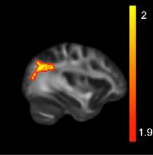 kutatócsoportunk 2009-ben végezte az első fmri mérést Szegeden, ahova a módszertant hoztam haza Oxfordból.