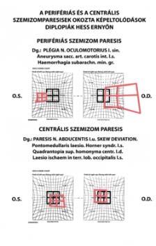 tekintési irányban saccadikus szemmozgások Dokumentálni!