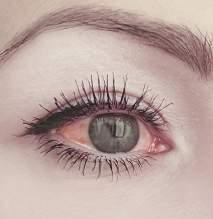 idegentest-érzést, valamint a szemszárazságot, és csökkenti a szem kivörösödését. Tartósítószer-mentes és felbontás után 6 hónapig felhasználható.
