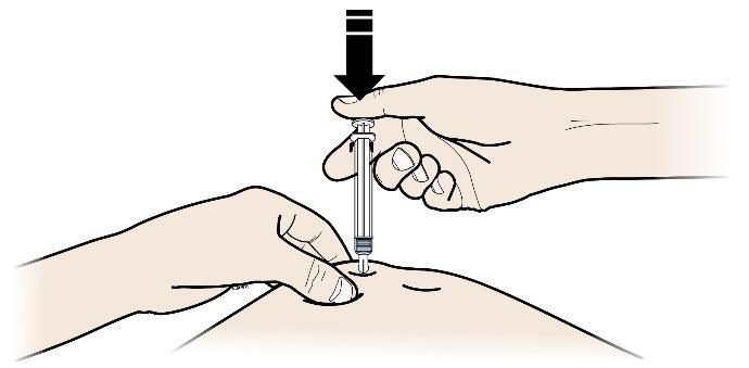 Fontos, hogy az injekció beadása alatt tartsa mindvégig összeszorítva a bőrét. A 3.