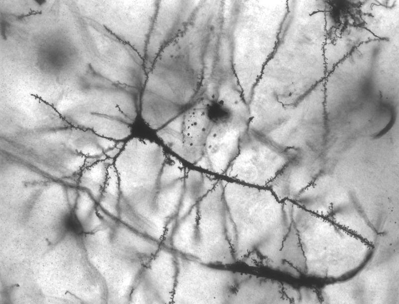 A környéki idegrendszerben levő neuronok sejttestei dúcokban csoportosulnak.