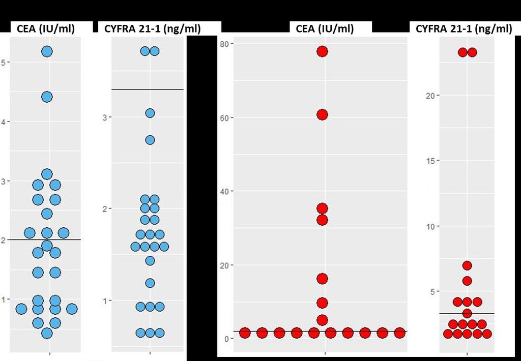 27. ábra. Az adenóma és CRC plazmaminták CEA és CYFRA 21-1 szintje. Rövidítések: CEA carcino-embrionális antigén; CYFRA 21-2 citokeratin 19 fragmens; CRC vastagbélrák. 5.3.