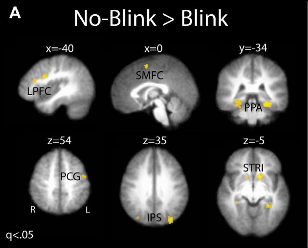 Inattentional blindness és attentional blink természetes képek esetében LPFC