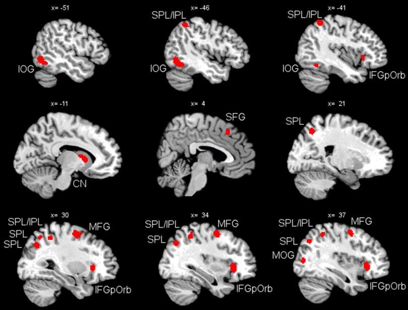 A tudatos vizuális feldolgozás agyi korrelátumainak meta-analízise 19 vizsgálat alapján IOG = inferior occipital gyrus, MOG = middle occipital gyrus, IFGpOrb = inferior frontal gyrus, pars orbitalis,