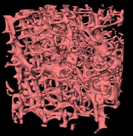 3-D computer tomography, human cadaver vertebral bone A csigolya