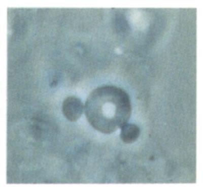 Microscopos polyangitis MPA Klasszifikációs