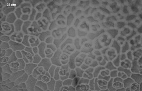 Szini (adaxális) epidermisz b. Fonáki (abaxális) epidermisz Figure 3. Anisocytic stomata of the upper (adaxial side) and lower (abaxial side) surface of the leaf of Armoracia lapathifolia. a. upper (adaxial) epidermis, b.