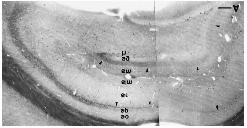 3. ábra A, B) A dorzális hippokampusz CB 1 immunfestése kis felbontású fénymikroszkópos képen.