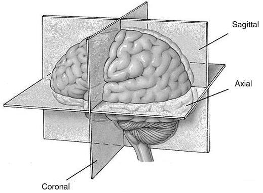 4.4. Képsíkok Bár az MR képeket önkényesen bármilyen irányban és helyen felvehetjük igazodva a többi képalkotó modalitásnál bevált szokásnak megfelelően MRI-ben is 3