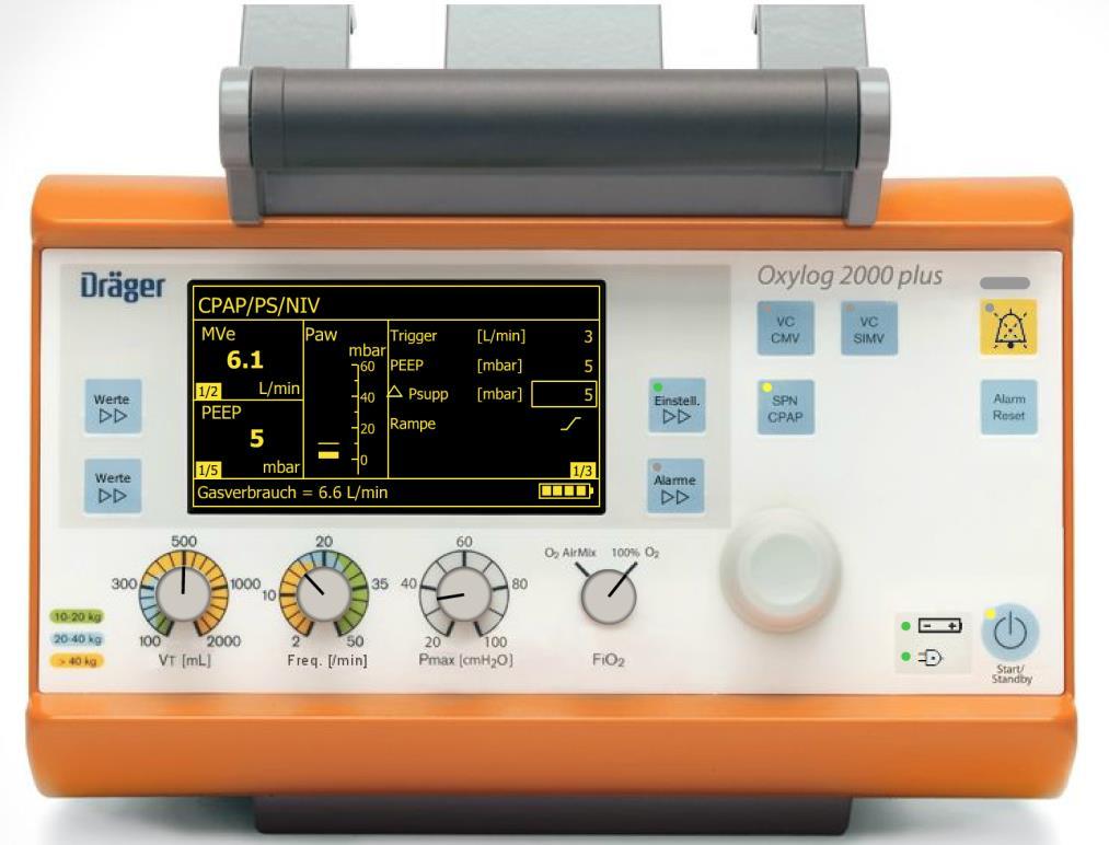 Oxylog 2000 plus kezdeti beállításai noninvazív lélegeztetéshez Trigger: 3 l/min PEEP: 5 mbar Kiválasztandó mód P supp: 5-8 mbar SPN CPAP A