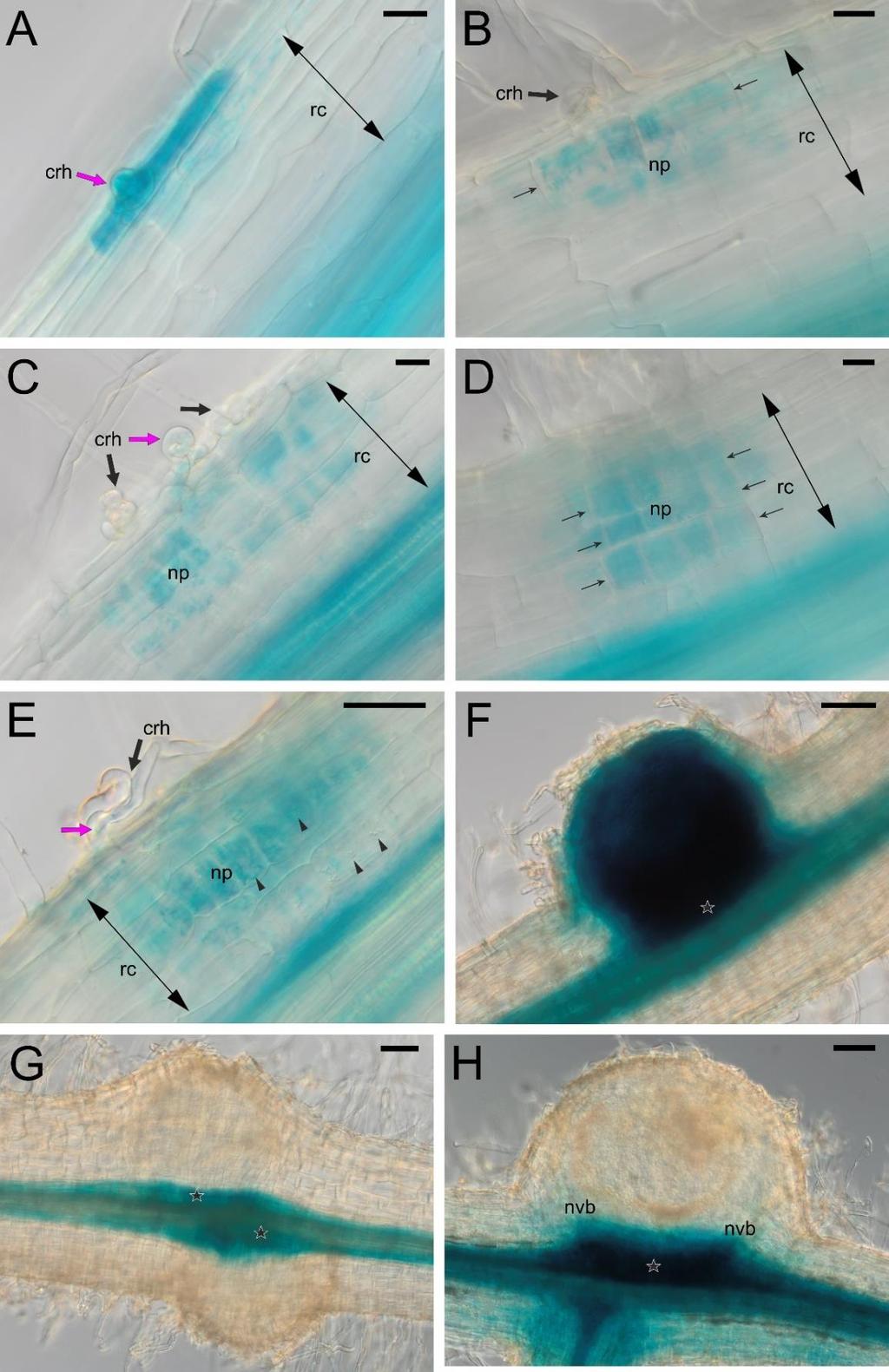 Figure S12. The pattern of LjPIN6 expression in the initial (A, B, C, D, E) and emerged (F, G) root nodule primordia and in juvenile, 20 dpi, nodules (H).