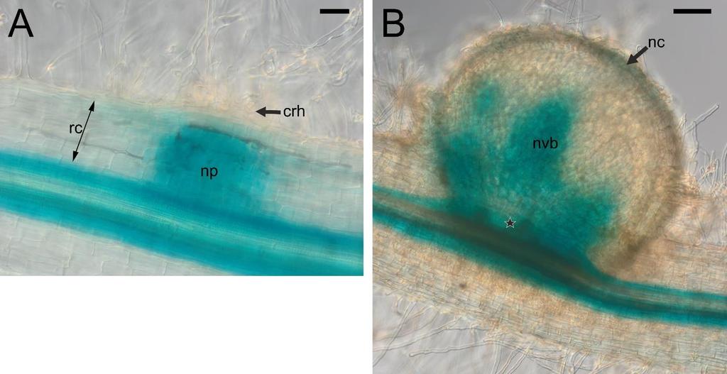 Figure S7. The pattern of LjPIN1 expression in the "hidden" (A) and "emerged" (B) root nodule primordia.