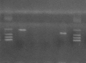 A HLA-A*0201 szubtípus I. PCR reakciók M 11 34A 35A 36A M 01A 02A 03A 04A 05A 06A 07A 08A09A10A11A12A13A 14A 15A 16A 17A 18A 19A M II. PCR reakciók 2. sz. ábra: Az 1.és 2.