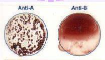 ismeretlen =minta antitest kimutatás (2) Makró és mikró módszerek a
