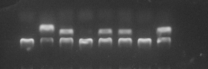 11v048 - ABO Az eredmény kiértékelése: O 1 : pozitív; B: pozitív ABO genotípusa: BO 1 genotípus A genetikai