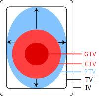 2.2. ábra. GTV: A látható tumor térfogata. CTV: A GTV-t és a körülötte lévő tumoros sejteket szórványosan tartalmazható térfogat. PTV: Tervezési céltérfogat.