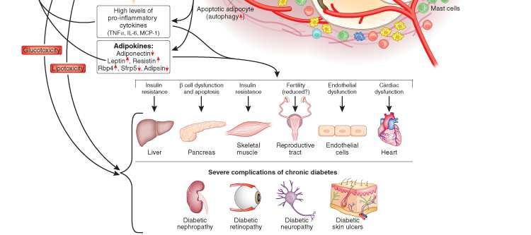 Loss of insulin stimulated GLUCOSE uptake fibrosis: disruption of adipocyte extracellular matrix stimulated pro-inflammatory state of