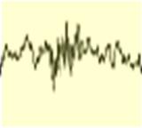 EEG Ébrenlét-feszült figyelem - β/γ (20-80 ( Hz) Nyugodt ébrenlét - α (8-13( Hz) CX LA 1 - θ (3-7 Hz) -60 mv LA 2 lassu