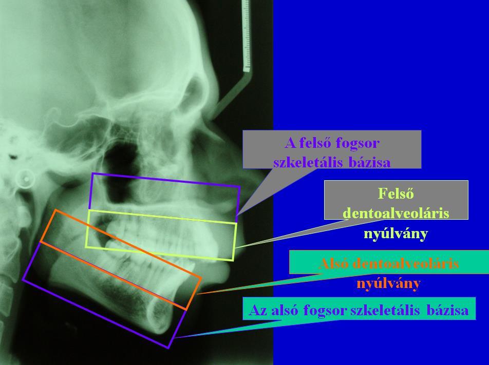 ALAPFOGALMAK FOGSZABÁLYOZÁS ÁLLCSONTORTOPEDIA A FOGSZABÁLYOZÁS A SCELETALIS ELTÉRÉSEKNEK A FIZIOLÓGIÁS, DENTO- AZ ÁLLCSONT-ORTOPÉDIAI ALVEOLARIS KIEGYENLÍTÉS SZÁMÁRA A MEGOLDHATATLAN FOGSZABÁLYOZÓ