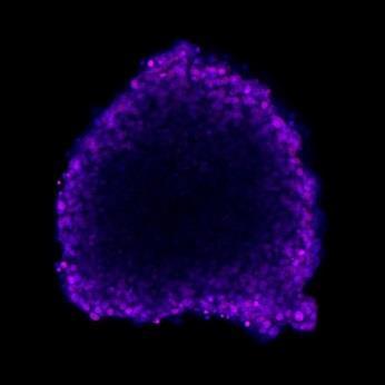 MDA-MB-435Br szferoid  200