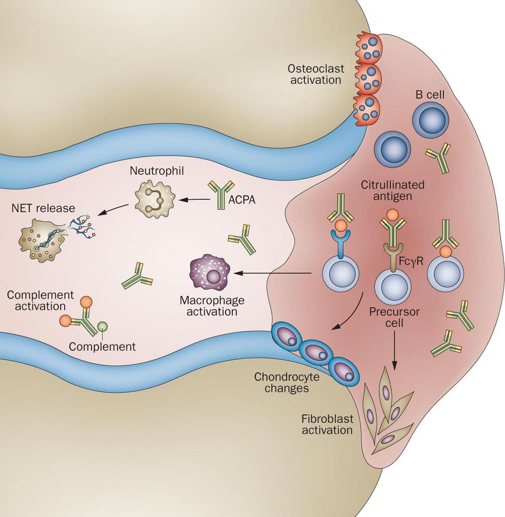 Summary of the pathogenic roles of ACPAs in RA ACPA-immunkomplexek: Macrophagok stimulálása FcγR-n vagy TLR-en keresztül TNF-α Osteoclast precursorok calciumban gazdag környezetben PAD-t