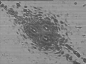 pontosságának mértéke (eltolóasztal mikrométer orsójának skálázása), a lövési kráterek középpontjai távolságának mikroszkóp alatti leolvasási pontossága határozza meg.